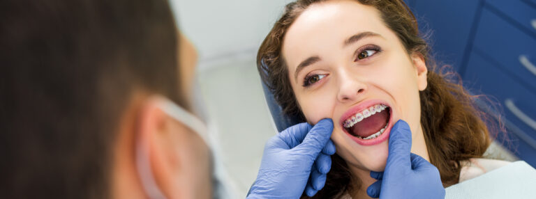 Dental Braces: What You Need To Know About Houston Dental Providers