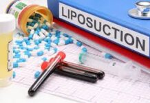 Unveiling the Beauty Within: Liposuction in Dubai as a Path to Self-Transformation Liposuction