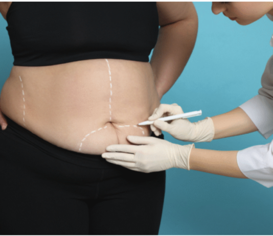How to Choose a Bariatric Surgeon for Your Weight Loss Needs Bariatric Surgeon