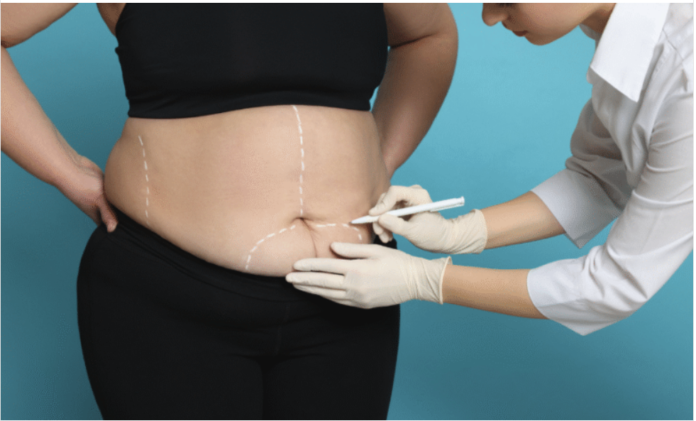 Bariatric Surgeon